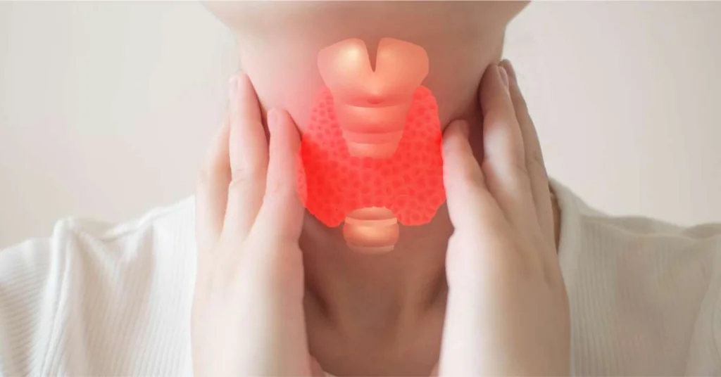 Soja a Hashimoto – czy jest dozwolona? 2 soja a hashimoto